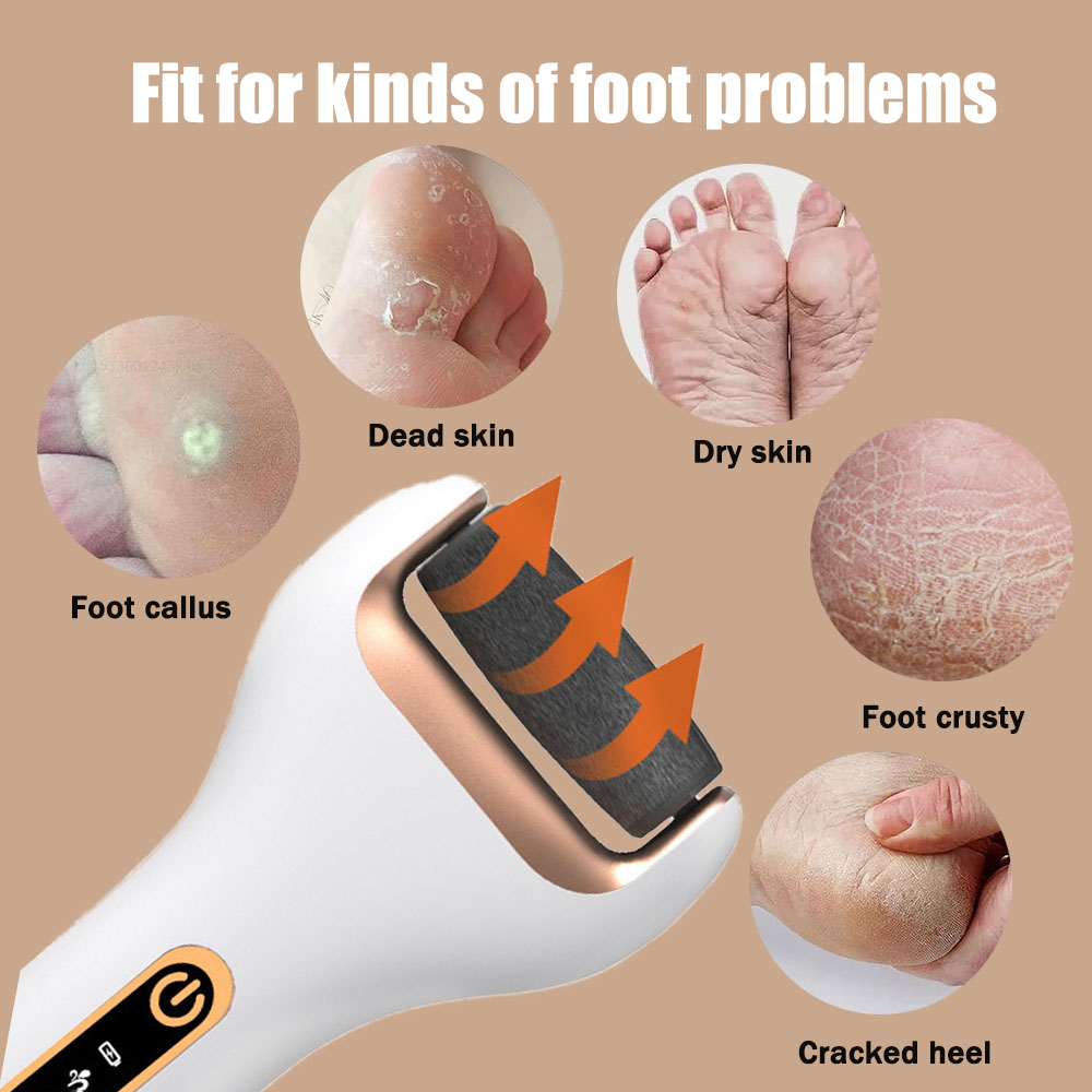 Rechargeable Electric Foot Ras - đánh giá và giá Woodworking Rasp